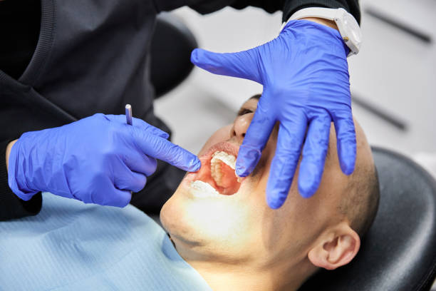 Best Emergency Wisdom Teeth Removal in Fulton, IL